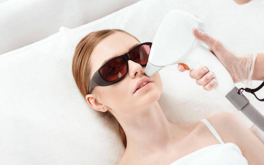 Лазерная эпиляция лица