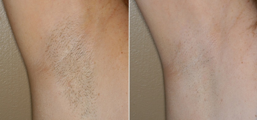 Результаты