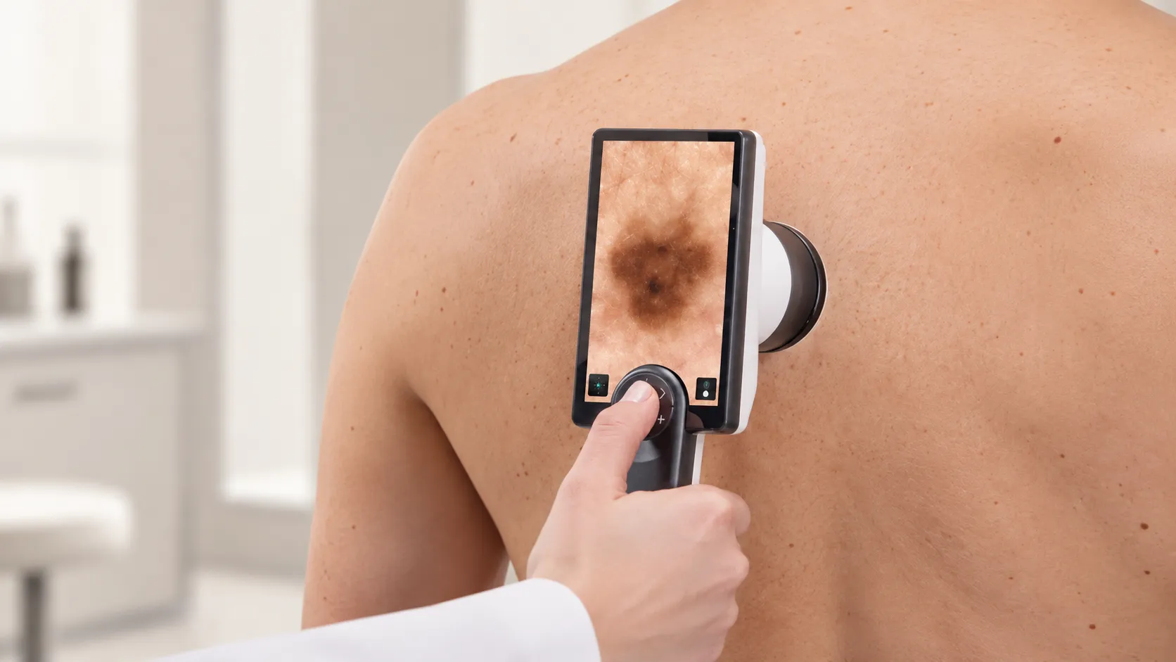 Dzimumzīmju pārbaude un digitālā kartēšana ar Canfield un DermaGraphix®